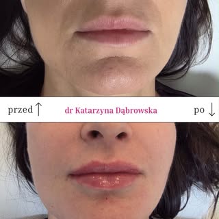Naturalny efekt to zawsze najlepszy efekt. Delikatne podkreślenie kształtu, poprawa proporcji i nawi
