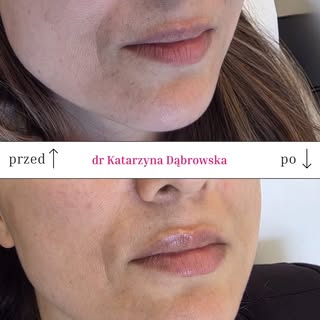 Takie naturalne podkreślenie konturu i ujędrnienie czerwieni wargowej to coś,co lubię najbardziej. W
