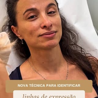 Nova técnica aqui na clínica... 😂😂😂

#viralvideos #foryoupage💙 #reelstrending #trending