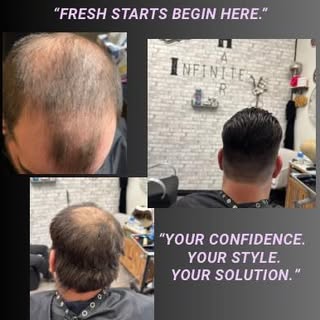 #lehighvalleypa #lehighvalleypahair #hairreplacementspecialist #hairreplacements #hairreplacementleh