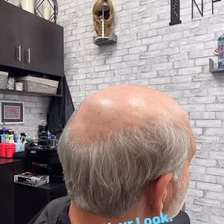 #HairReplacementSpecialist #HairLossExpert #TrichologySalon #HairClinic #HairStudio #SalonSuite #Pri