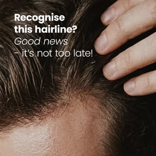 This is exactly the stage where our treatment works best. Your follicles are still active and we'll 