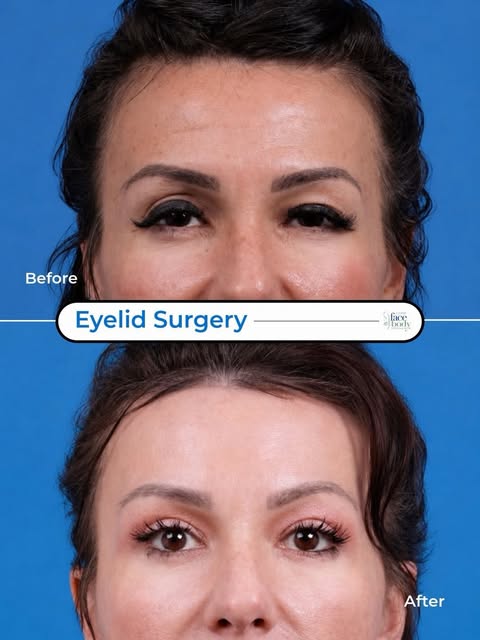 Why does one eye look more open than the other? 👀

Eyelid asymmetry is completely natural. But when