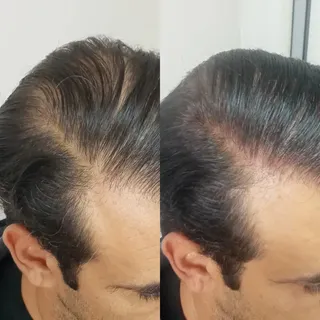 Generando un efecto de más densidad, resultado después de la Primera sesión. 
En este caso, al tener
