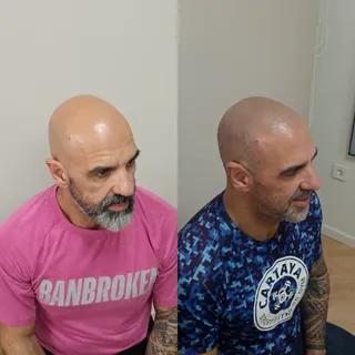 Resultado después de acabar la tercera sesión.

En este caso probablemente vayamos a necesitar una c
