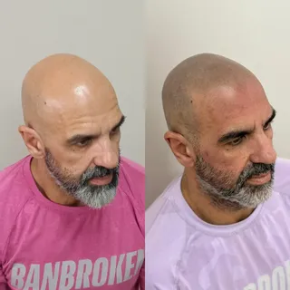 Resultado después de una cuarta y última sesión. Linea frontal como suele ser mi estilo, fiel a cabe