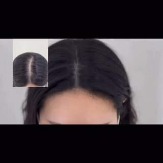 From visible scalp to seamless density.
Soft. Natural. Undetectable. ✨

#scalpmicropigmentation #smp