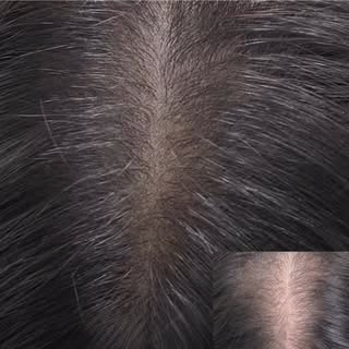 The power of density. 
Thinning at the part is one of the most common concerns I see, but SMP offers