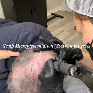 Thinning hair? Let’s fix that.
Our custom Scalp Micropigmentation (SMP) treatments at Lamoon PMU in 