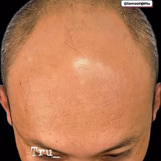 The perfect blend doesn’t exist? Think again!
We brought back a soft, age-appropriate hairline with 