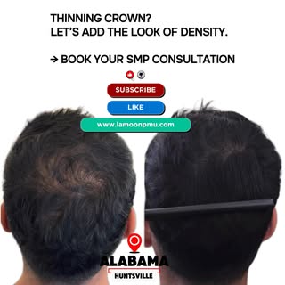 Stop stressing over your thinning crown. 👊
You don’t have to live with see-through hair or spend ye
