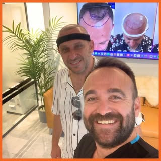 🫡 More Than 20+ Countries | Hair Transplant #ferhadyildiz #hairtransplantturkey #hairtransplantista
