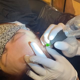 Scalp Micropigmentation (SMP)

Tiny micro-dots, placed in the scalp, creating the illusion of densit
