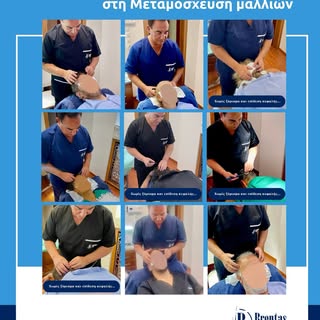 ✨ 30 χρόνια εμπειρίας, ακρίβειας και φυσικού αποτελέσματος στη Μεταμόσχευση Μαλλιών!
Ο Δρ. Brentas κ