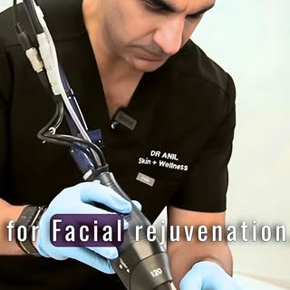 What is SMART PRP®?

A combination approach for optimal Acne Scarring treatment:

• Subcision – rele
