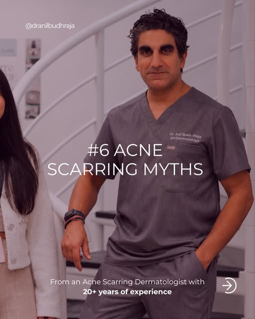 6 acne scarring myths from a dermatologist of 20 years ✦

Most people trying to treat their acne sca