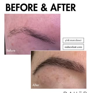 No shortcuts. No guesswork.
⠀⠀⠀⠀⠀⠀⠀⠀⠀
Just expert technique and results that speak for themselves ✨
