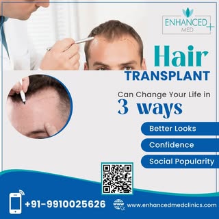 #hairtransplantation #hairtransplant #fue #hair #hairloss #transplantecapilar #hairtransplantistanbu