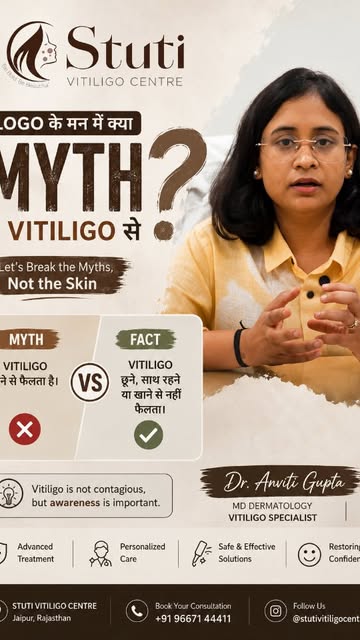 🧠 **MYTH vs FACT: Vitiligo**

Vitiligo **is NOT contagious**. You cannot get vitiligo by touching, 