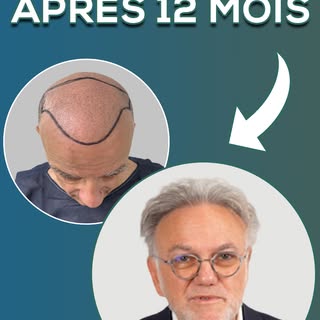 À 62 ans, Bruno a décidé de sauter le pas et de retrouver sa liberté ✨

Découvrez le témoignage insp