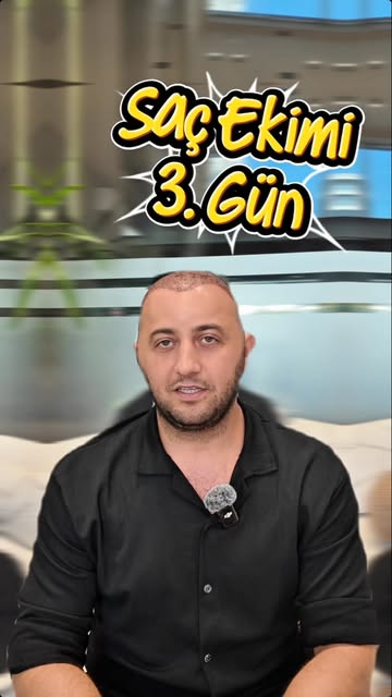 Saç ekimi sürecinde 3. gün… 🎥🌿

Ekimin ardından süreç, kişiye özel planlama doğrultusunda yakından