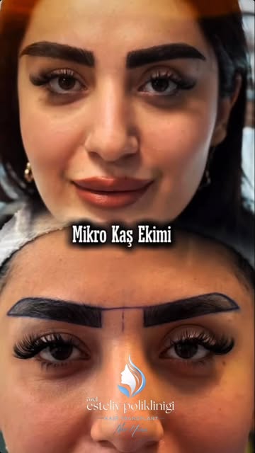 Kaşın yönü, yüzün ifadesini belirleyen detaylardan biridir. 👀

Mikro Kaş ekiminde yalnızca yoğunluk