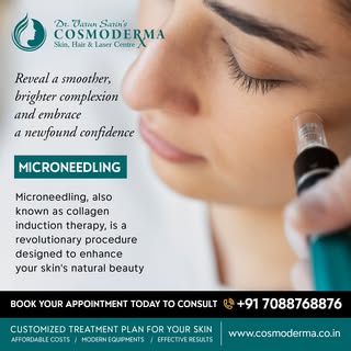 Say hello to flawless and rejuvenated skin with our cutting-edge microneedling treatment at Cosmoder
