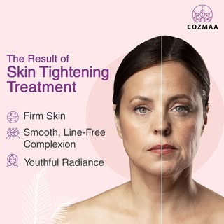Turn back the clock with our skin tightening treatment at Cozmaa. 

Unveil a firmer, more lifted ver