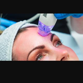 ✨ Reveal smoother, firmer, more radiant skin with RF Microneedling ✨

Looking to improve your skin w