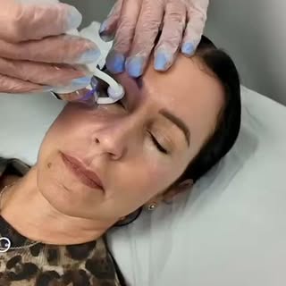 ✨ Microneedling, but make it LIFTED. ✨

Want smoother, firmer-looking skin without surgery? 💫

Our 
