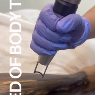 Sun tan, uneven skin & dullness — gone in minutes ✨
Experience the power of Carbon Laser for body ta