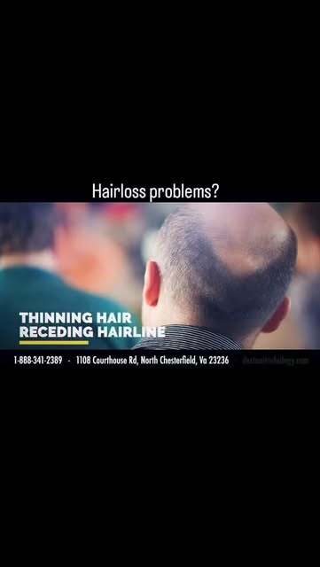 #Alopecia #hair #trichology #Trichologist 

Www.destanitrich.com 

Many people are unaware that ther