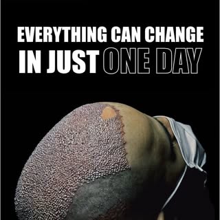 ✨ Everything Can Change in Just One Day ✨

Hair loss may take years to happen, but the first step to