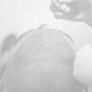 From hair loss to hair confidence - results that speak for themselves. 

📞 Book your consultation t