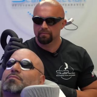🚨 Scalp micropigmentation destroyed my client's confidence.

This is the beginning of Aggie's laser