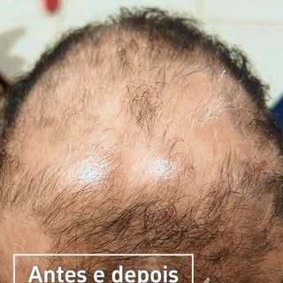 O resultado que você busca no espelho não é fruto de promessas milagrosas; é o reflexo direto de um 