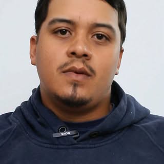 Muitas vezes, a queda capilar severa começa de forma silenciosa. No caso do Matheus, uma pequena fal