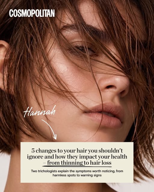 Hannah talks to Cosmopolitan about 5 hair loss changes you shouldn’t ignore.

From increased sheddin