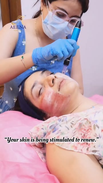 ✨ Ultimate Glow. Smoother Skin. Youthful You. ✨

Struggling with acne scars, open pores, fine lines,