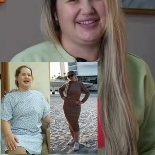 ✨ From confidence lost to a life transformed! 💃 Darya’s stunning journey began with Dr. Cyrus, the 