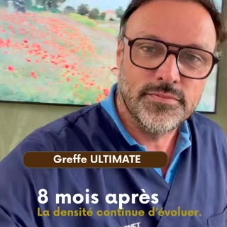🩺 Greffe capillaire ULTIMATE : évolution à 8 mois

Petit point d’évolution de ma greffe capillair