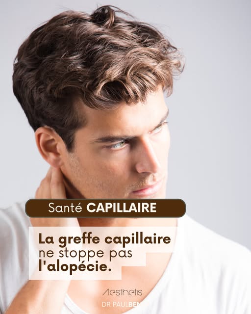 Le reel a expliqué pourquoi associer un traitement à la greffe est une bonne stratégie. 
Ce carrous