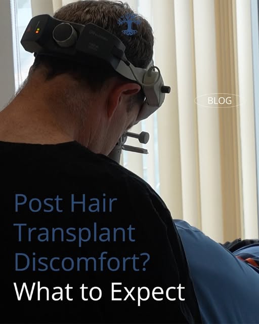 Post Hair Transplant Discomfort? What to Expect

"For many, the brief period of discomfort is a smal