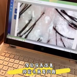 别等到头发出问题，才发现头皮其实更重要。
经常染发、拉直或烫发，都会慢慢影响头皮健康。

从 Bee Choo 草本头皮护理 开始，好好照顾你的头皮。
头皮健康了，头发自然就好。 🌿
