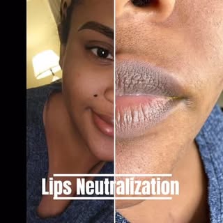 Lip Neutralization ✨
Correcting dark tones and bringing back a soft, even color for naturally beauti