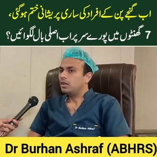 Hair Transplant by Dr Burhan Ashraf 0092 308 1423186 
#hairtransplant #hairtransplantsurgeon #hairre