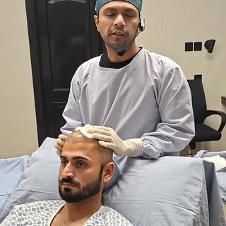 Hair Transplant by Dr Burhan Ashraf #foryou #viralvideo #hairtransplant #drburhan #wbesthetique