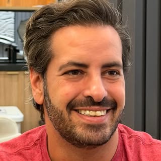 Um transplante bem planejado pode permitir que o paciente use o cabelo da forma que preferir.

Por i