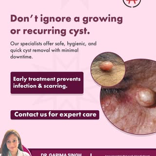 A growing or recurring cyst should never be ignored.

Whether it’s painless or uncomfortable, early 