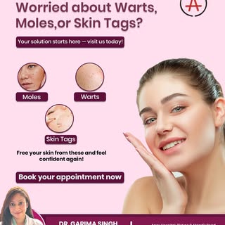 Warts, moles, or skin tags making you uncomfortable or affecting your confidence?

You don’t have to
